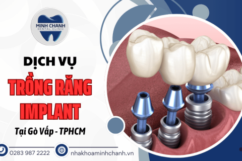 Nha khoa trồng răng implant uy tín, giá tốt tại Gò Vấp, TPHCM