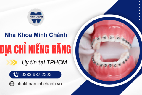 Niềng răng tại TPHCM ở đâu tốt? Địa chỉ được nhiều người tin chọn