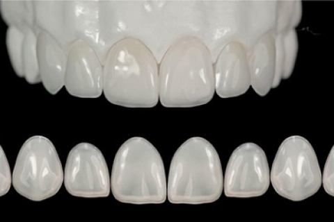 Răng sứ E-max
