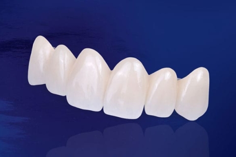 Răng sứ Zirconia