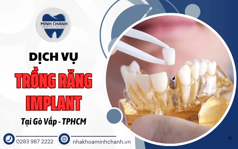 trồng răng implant