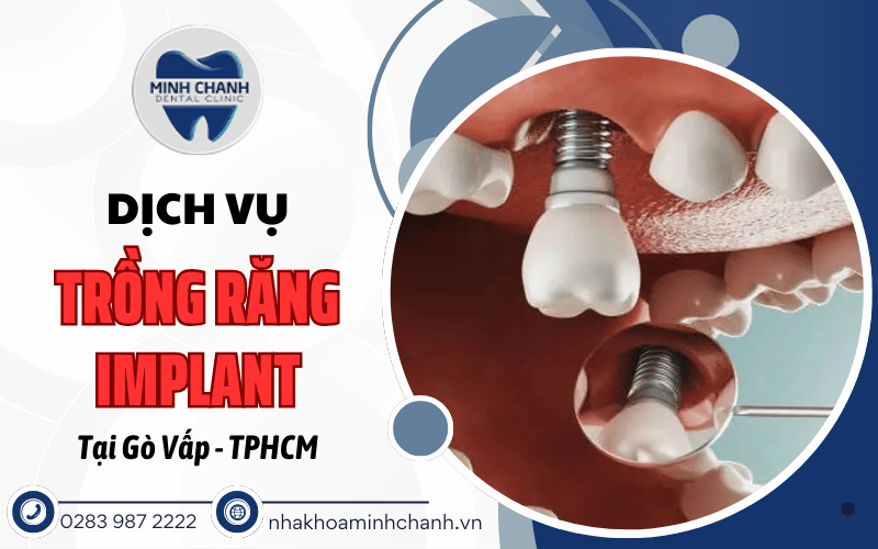 trồng răng implant