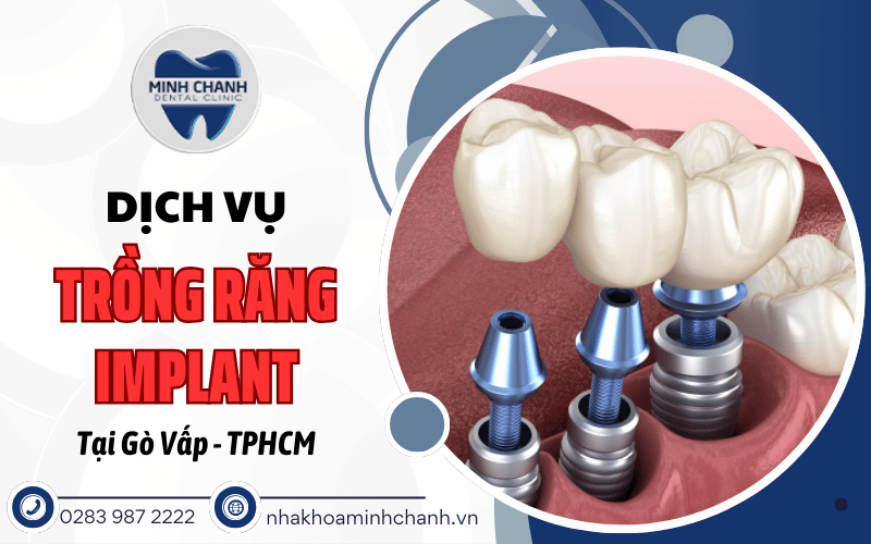 trồng răng implant