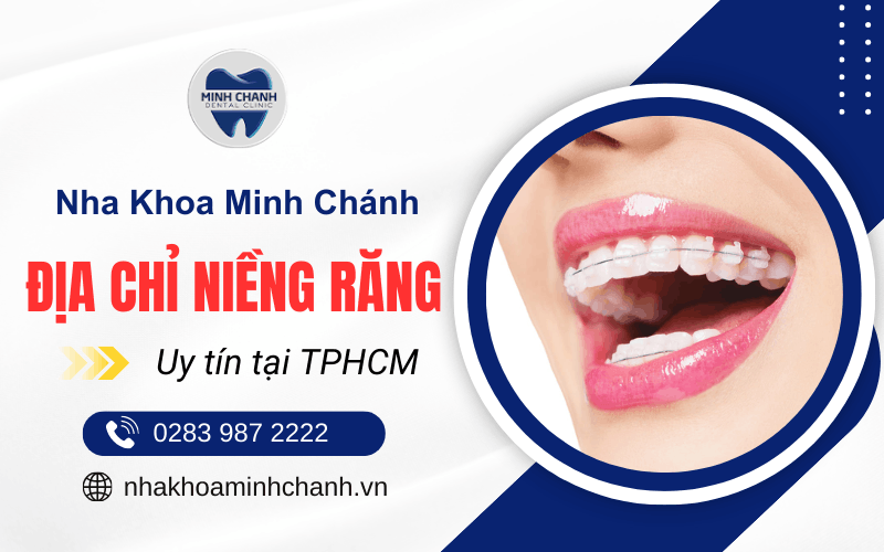 niềng răng tại TPHCM