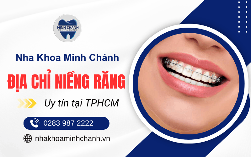niềng răng tại TPHCM