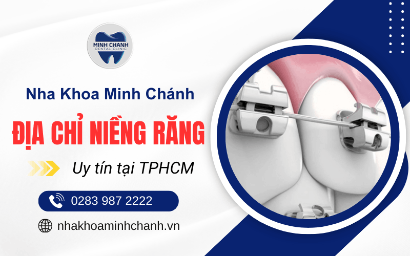 niềng răng tại TPHCM
