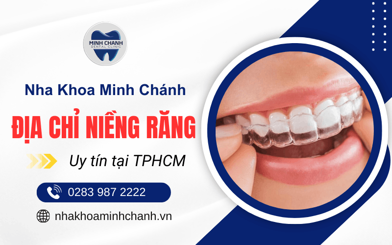 niềng răng tại TPHCM